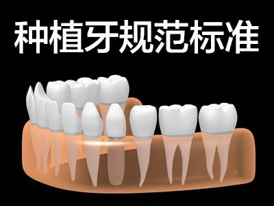 天津北辰瑞士种植牙价格表-种植牙多少钱