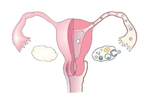 从哪些方面看出是多囊卵巢综合征