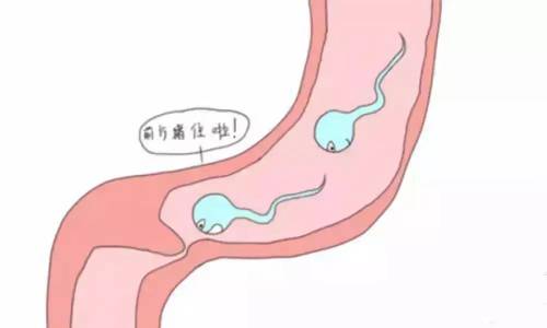 出现输卵管堵塞，是什么病因所致?