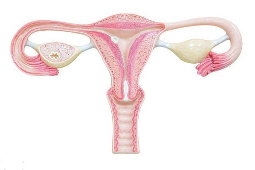 为什么会出现多囊卵巢双侧的现象