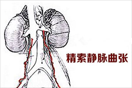 睾丸静脉解剖图图片