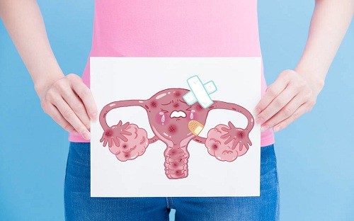 子宫肌瘤能怀孕吗？
