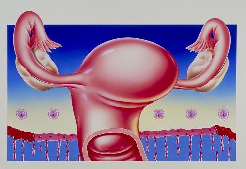多囊卵巢是怎样的让你做不成妈？