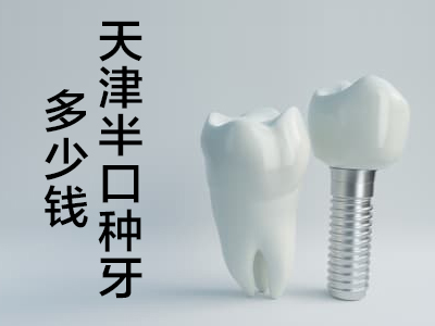 天津人工种植牙多少钱一棵
