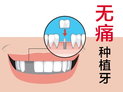 天津市有种植牙的吗_中诺口腔_牙科选择