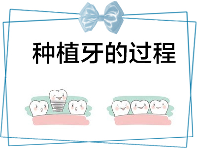 天津种植牙手术全过程