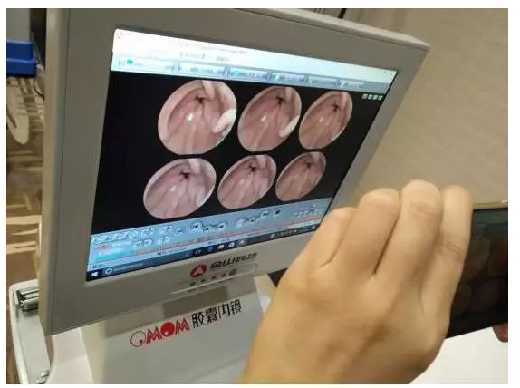 关于南宁东大医院的“磁控电子胶囊胃镜”,各位想了解的都在这里!