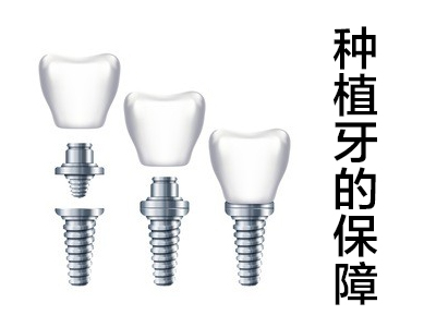 天津韩国种植牙品牌排行榜名称_天津牙科_选择中诺
