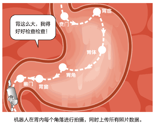 南宁东大中医医院医生：胃不舒服，胃镜检查仅需一粒胶囊随水吞服即可