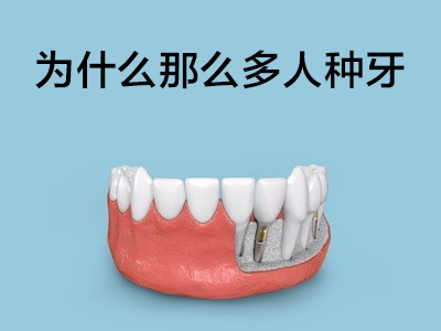 天津全口半口种植牙的优势与弊端