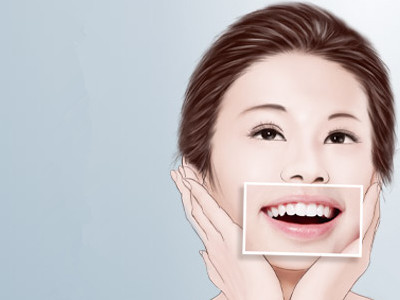 天津隐形牙齿矫正图片，什么是隐形牙齿矫正？