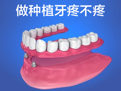 天津全口半口种植牙到底痛不痛