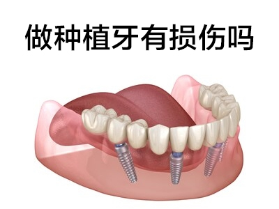 天津半口种植牙对比图，什么是半口种植牙