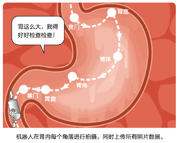 吞下一颗胶囊就能做胃镜?南宁东大中医医院来给各位揭露真相：不是“忽悠”而是事实!