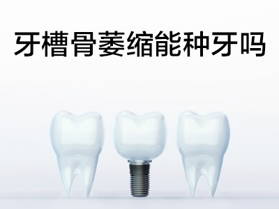 天津全口半口种植牙前牙植骨图片 植骨重要吗