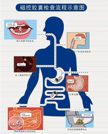 南宁东大中医肛肠医院磁控胶囊胃镜机器人，解决做胃镜三难问题