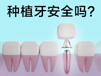 天津全口种植牙哪个医院比较好-全口种植牙医院-天津口腔医院中诺