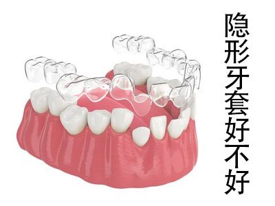 天津隐形牙齿矫正器-隐形牙套优势有哪些