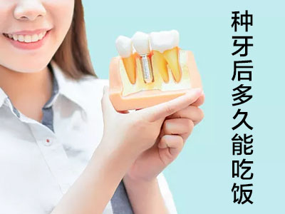 天津全口种植牙后多久可以刷牙-优质种植牙