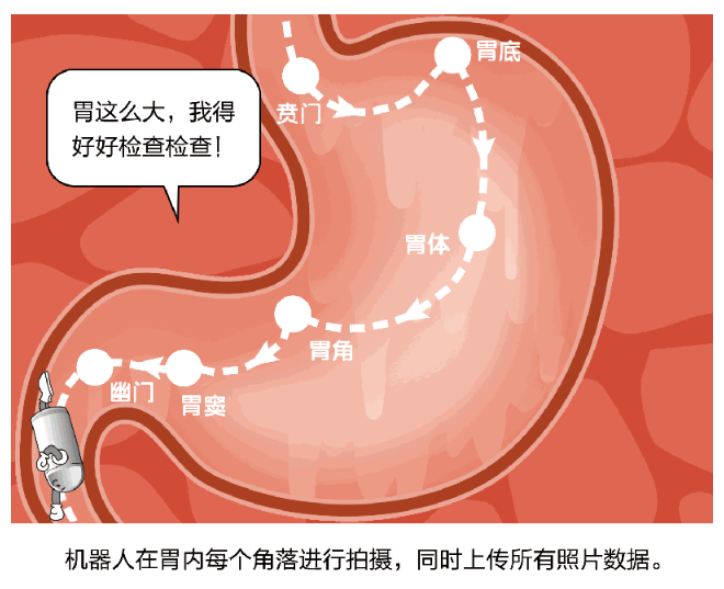 南宁东大中医医院重磅好消息!做胃镜再也不怕痛苦了——磁控胶囊胃镜!