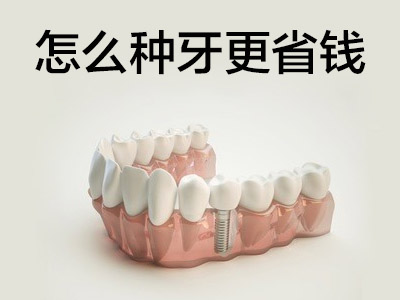 天津全口种植牙术后多久拆线-全口种植牙-种植牙术后可以吃什么