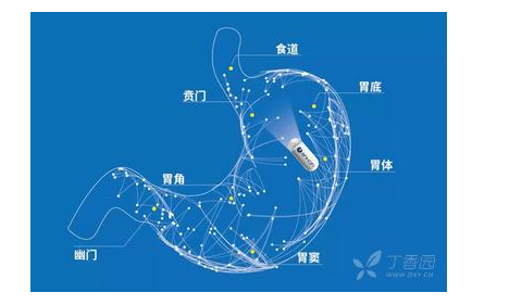 一粒小小胶囊即可无痛胃镜检查!南宁东大这家医院推出一神器