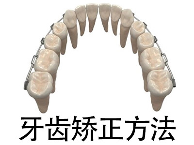 天津牙齿正畸的详细过程 牙齿矫正的步骤