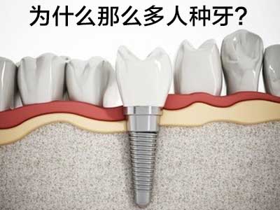 天津全口种植牙后正常图片-种植牙的过程