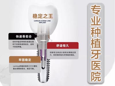 天津三甲医院全口种植牙多少钱一颗多少钱