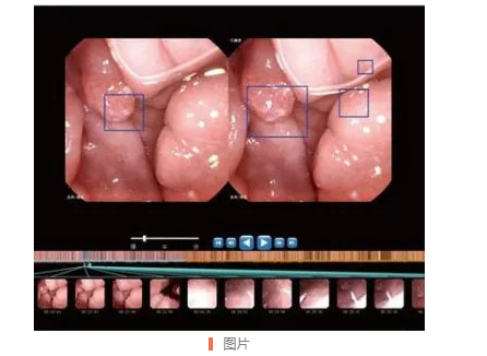 南宁东大医院今年上新一款电子胶囊无痛胃镜，做胃镜检查再也不怕痛了