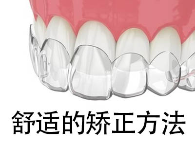 天津牙齿正畸哪一种托槽好 传统正畸的几种托槽