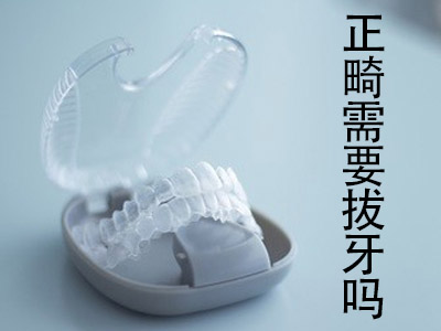 天津牙齿正畸需要拔牙吗 正畸拔牙拔哪几颗