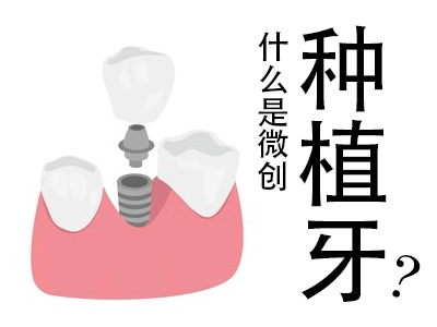 天津安全口种植牙齿痛不痛，产生疼痛怎么办