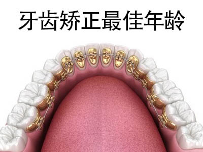 天津小朋友地包天牙齿矫正的zui佳年龄