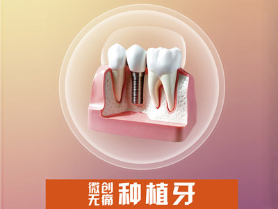 天津全口种植牙zui少要做多少颗，全口种植牙方案