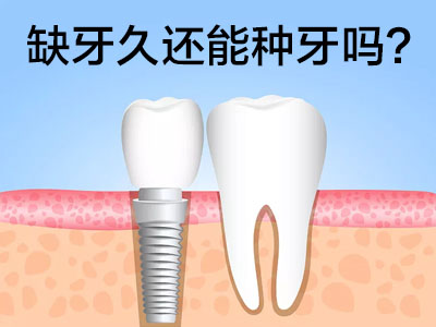 天津全口半口种植牙前牙植骨图片 种植牙为什么植骨