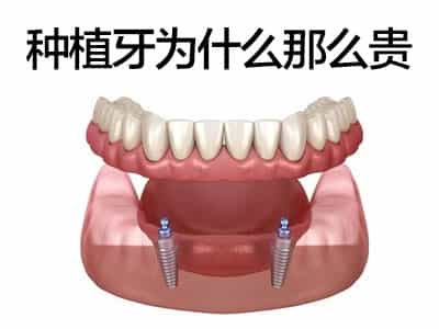 天津老人种一口牙要多少钱
