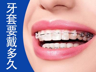 天津全口种牙要多少钱  选择中诺安全高品质