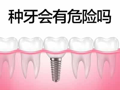 天津半口种植牙能用多久  如何选择