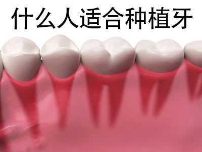 高质量种植还是选择中诺  天津全口种牙可以种植牙吗