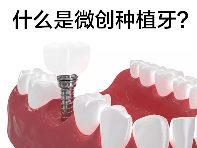 天津Dentium满口种植牙需要几个桩