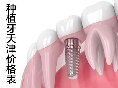 天津Dentium医院种牙多少钱合适-种植牙详细价格