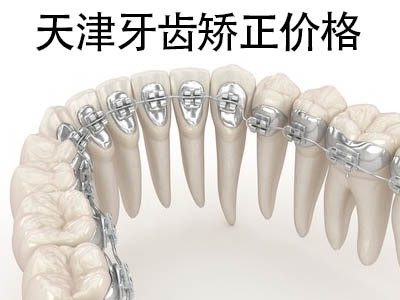天津市口腔医院正畸价格 牙齿矫正大概价位