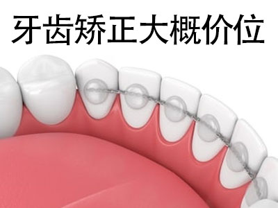 14岁牙齿矫正天津价目表 牙齿矫正能贵吗