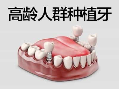 天津OSSTEM全口种植牙后怎样维护，注意哪些情况