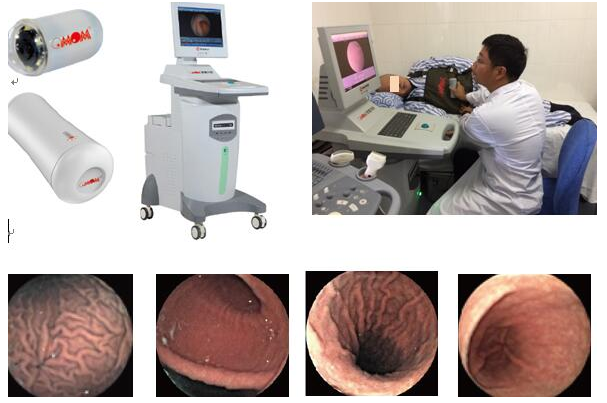 为您揭开南宁东大中医医院的“黑科技”胶囊电子胃镜系统神秘面纱～