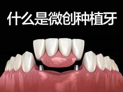 天津种植牙放二期基台疼吗，种植牙疼痛感能忍受吗