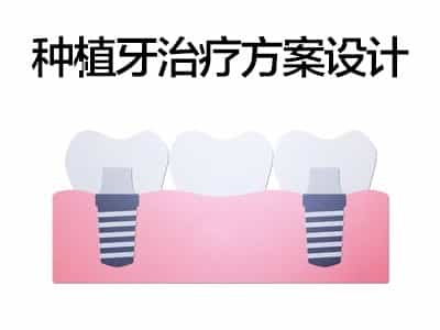推荐安全质量治疗方案 天津种植牙基台有几种
