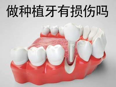 普及安全治疗 天津种牙 核磁共振的情况