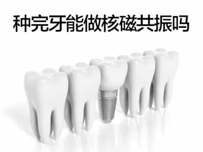 天津种植牙能做核磁共振检查吗，种植牙材质会影响做核磁共振吗